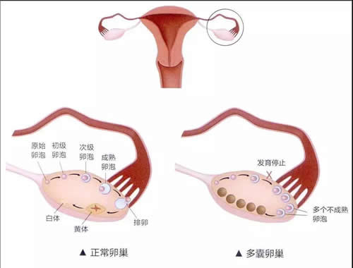 卵巢功能和生孩子有关吗?如何保养卵巢？